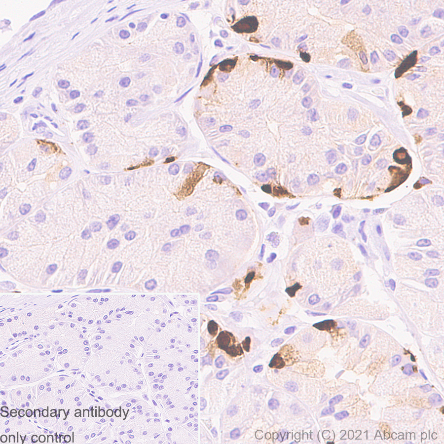 Immunohistochemistry (Formalin/PFA-fixed paraffin-embedded sections) - Anti-Chromogranin A antibody [RM1025] (AB283265), expandable thumbnail