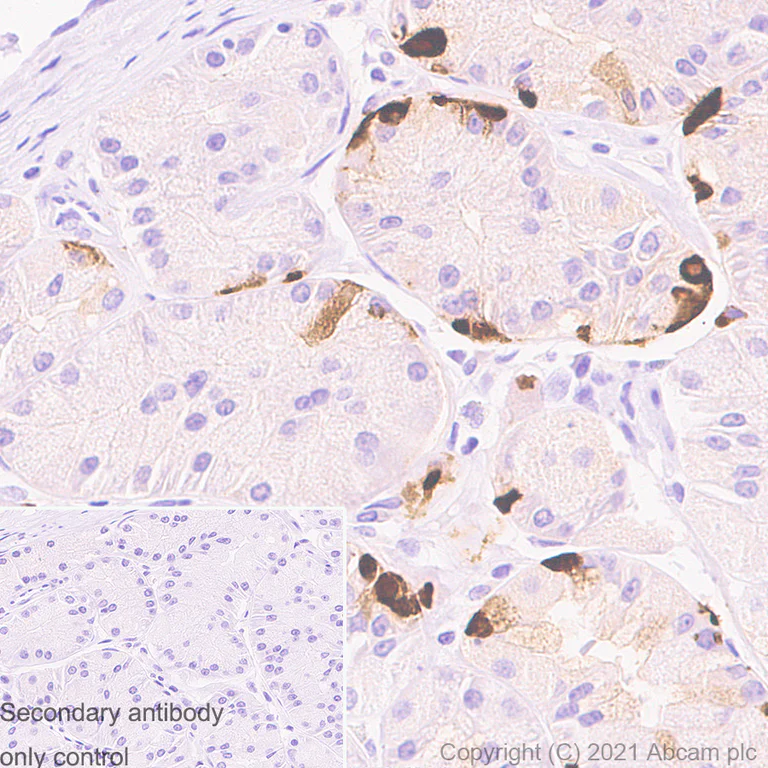 Immunohistochemistry (Formalin/PFA-fixed paraffin-embedded sections) - Anti-Chromogranin A antibody [RM1025] (AB283265)