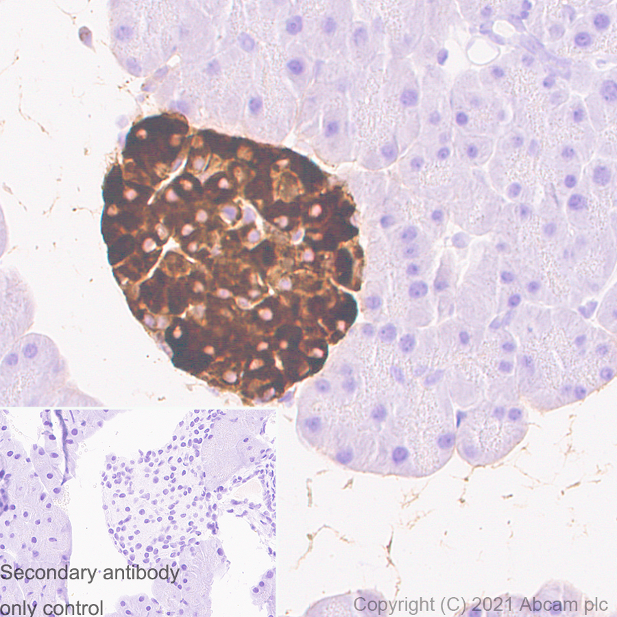 Immunohistochemistry (Formalin/PFA-fixed paraffin-embedded sections) - Anti-Chromogranin A antibody [RM1025] (AB283265), expandable thumbnail