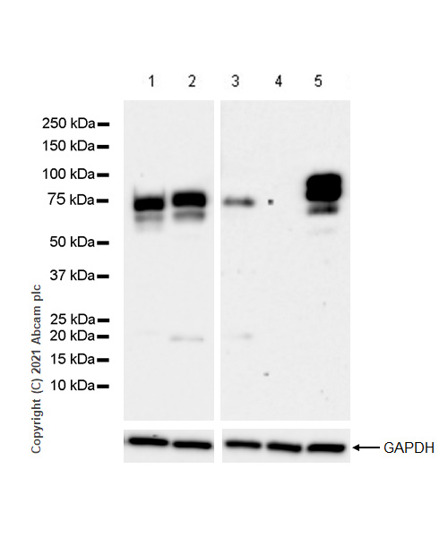 Western blot - Anti-Chromogranin A antibody [RM1025] (AB283265), expandable thumbnail