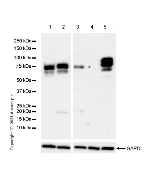 Western blot - Anti-Chromogranin A antibody [RM1025] (AB283265)