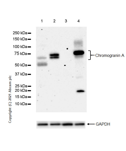 Western blot - Anti-Chromogranin A antibody [RM1025] (AB283265), expandable thumbnail