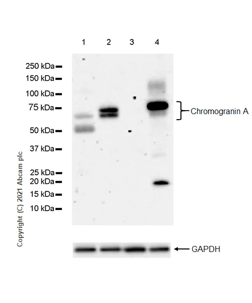 Western blot - Anti-Chromogranin A antibody [RM1025] (AB283265)