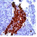 Immunohistochemistry (Formalin/PFA-fixed paraffin-embedded sections) - Anti-Chromogranin A antibody [SP12] (AB16693)