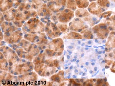 Immunohistochemistry (Formalin/PFA-fixed paraffin-embedded sections) - Anti-Chromogranin B antibody (AB12242)