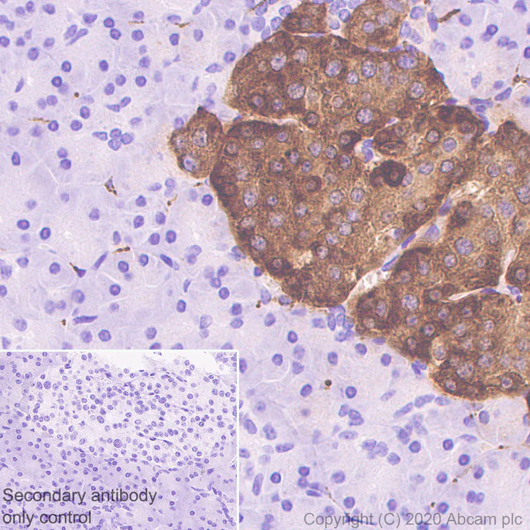 Immunohistochemistry (Formalin/PFA-fixed paraffin-embedded sections) - Anti-Chromogranin C/SGII antibody [EPR23876-52] (AB275019)