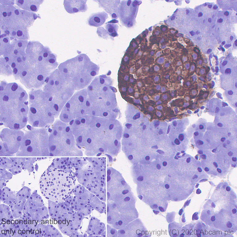 Immunohistochemistry (Formalin/PFA-fixed paraffin-embedded sections) - Anti-Chromogranin C/SGII antibody [EPR23876-52] - BSA and Azide free (AB275028)