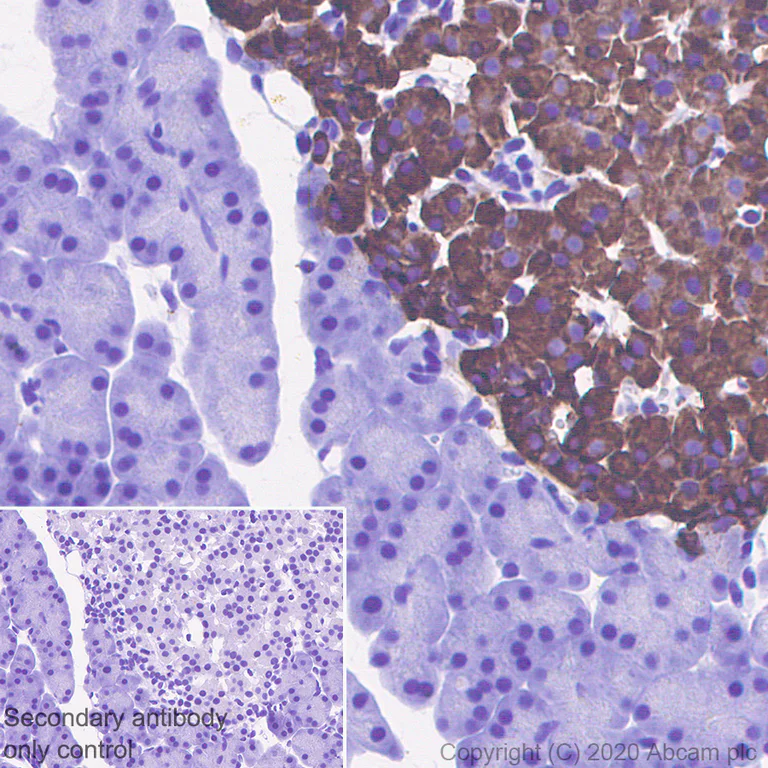 Immunohistochemistry (Formalin/PFA-fixed paraffin-embedded sections) - Anti-Chromogranin C/SGII antibody [EPR23876-52] - BSA and Azide free (AB275028)