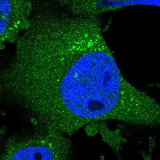 Immunocytochemistry/ Immunofluorescence - Anti-CHSS2 antibody (AB224495)