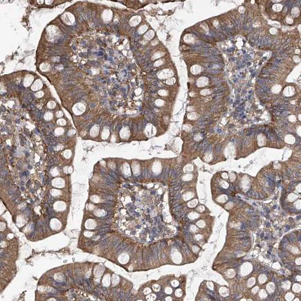 Immunohistochemistry (Formalin/PFA-fixed paraffin-embedded sections) - Anti-CHSS2 antibody (AB224495)