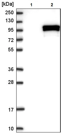 Western blot - Anti-CHSS2 antibody (AB224495)