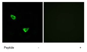 Immunocytochemistry/ Immunofluorescence - Anti-CHSS2 antibody (AB75052), expandable thumbnail