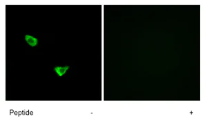 Immunocytochemistry/ Immunofluorescence - Anti-CHSS2 antibody (AB75052)