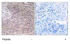 Immunohistochemistry (Formalin/PFA-fixed paraffin-embedded sections) - Anti-CHSS2 antibody (AB75052)