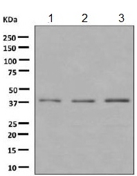 Western blot - Anti-CHST13 antibody [EPR9344] (AB155957), expandable thumbnail