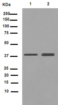 Western blot - Anti-CHST13 antibody [EPR9344] (AB155957), expandable thumbnail