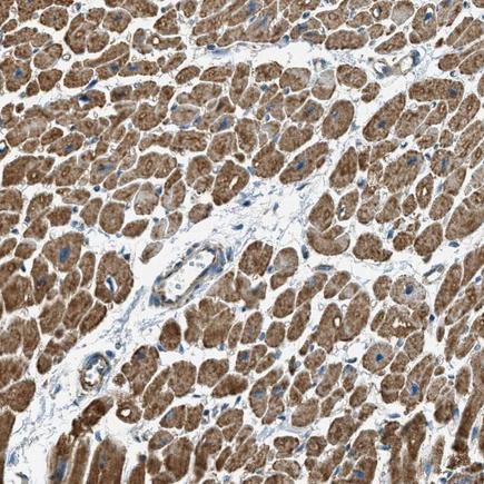 Immunohistochemistry (Formalin/PFA-fixed paraffin-embedded sections) - Anti-CHST15 antibody (AB224399)