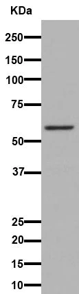Western blot - Anti-CHST3 antibody [EPR15789] - BSA and Azide free (AB251171)