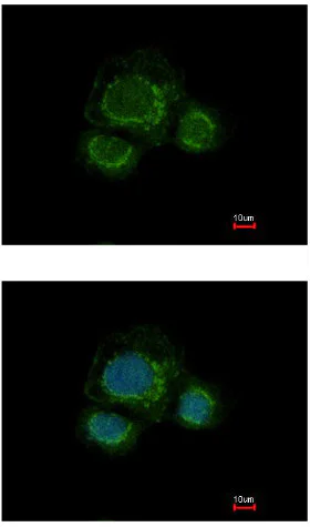 Immunocytochemistry/ Immunofluorescence - Anti-CHST7 antibody (AB154726)