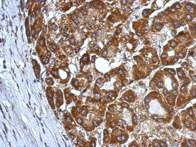 Immunohistochemistry (Formalin/PFA-fixed paraffin-embedded sections) - Anti-CHST7 antibody (AB154726)