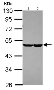Western blot - Anti-CHST7 antibody (AB154726)
