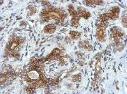 Immunohistochemistry (Formalin/PFA-fixed paraffin-embedded sections) - Anti-ChT1 antibody (AB154493), expandable thumbnail