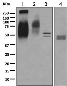 Western blot - Anti-ChT1 antibody [EPR9356] - BSA and Azide free (AB249083), expandable thumbnail
