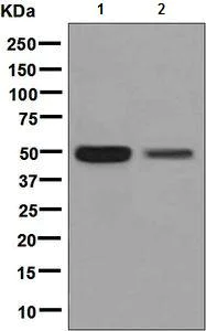Western blot - Anti-CHX10 antibody [EPR7022] - BSA and Azide free (AB248585)