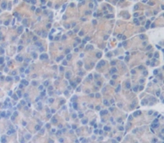 Immunohistochemistry (Formalin/PFA-fixed paraffin-embedded sections) - Anti-Chymotrypsin antibody (AB231724)