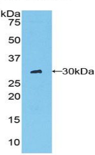 Western blot - Anti-Chymotrypsin antibody (AB231724)