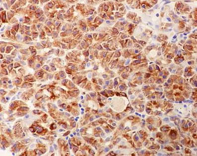 Immunohistochemistry (Formalin/PFA-fixed paraffin-embedded sections) - Anti-Chymotrypsin antibody [EPR13859] (AB187164)