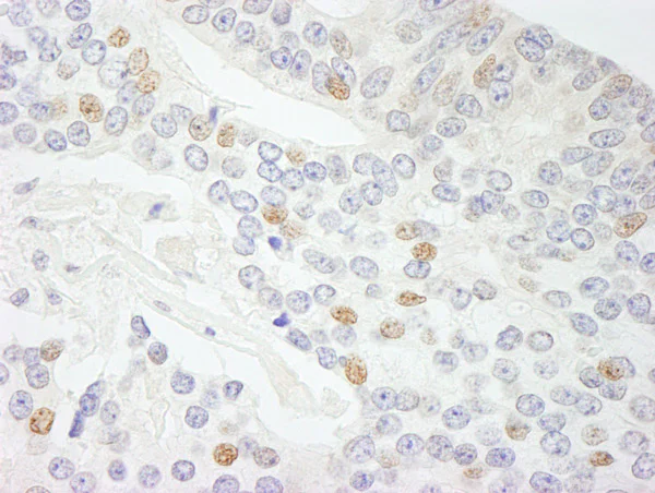 Immunohistochemistry (Formalin/PFA-fixed paraffin-embedded sections) - Anti-CIA antibody (AB70831)
