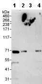 Western blot - Anti-CIA antibody (AB70831)
