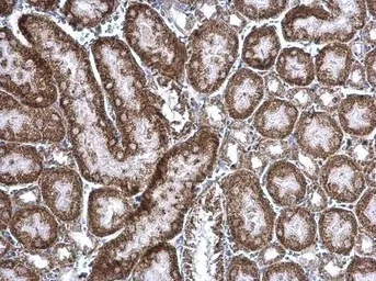 Immunohistochemistry (Formalin/PFA-fixed paraffin-embedded sections) - Anti-cIAP1 antibody (AB154525)