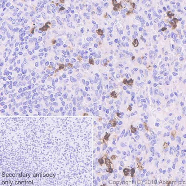 Immunohistochemistry (Formalin/PFA-fixed paraffin-embedded sections) - Anti-cIAP1 antibody [EPR4673] (AB108361), expandable thumbnail
