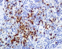 Immunohistochemistry (Formalin/PFA-fixed paraffin-embedded sections) - Anti-cIAP1 antibody [EPR4673] (ab108361), expandable thumbnail
