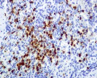 Immunohistochemistry (Formalin/PFA-fixed paraffin-embedded sections) - Anti-cIAP1 antibody [EPR4673] (AB108361)