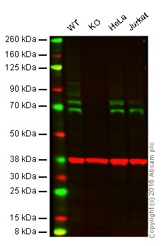 Western blot - Anti-cIAP1 antibody [EPR4673] (AB108361), expandable thumbnail