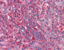 Immunohistochemistry (Formalin/PFA-fixed paraffin-embedded sections) - Anti-cIAP2 antibody (AB113237)