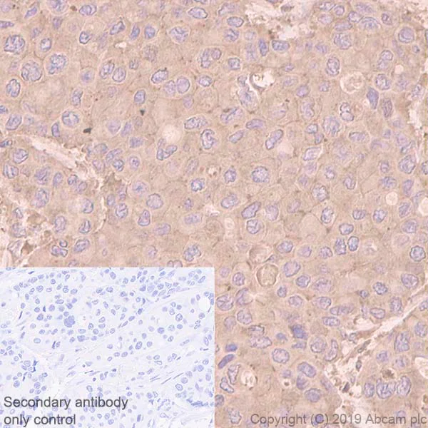 Immunohistochemistry (Formalin/PFA-fixed paraffin-embedded sections) - Anti-cIAP2 antibody [E40] (AB32059)