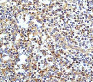Immunohistochemistry (Formalin/PFA-fixed paraffin-embedded sections) - Anti-cIAP2 antibody [E40] (AB32059)