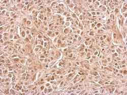 Immunohistochemistry (Formalin/PFA-fixed paraffin-embedded sections) - Anti-CIAPIN1 antibody (AB154904), expandable thumbnail
