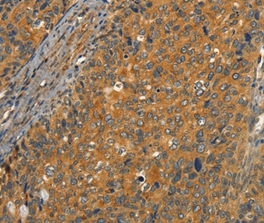 Immunohistochemistry (Formalin/PFA-fixed paraffin-embedded sections) - Anti-CIB1/KIP antibody (AB198845), expandable thumbnail