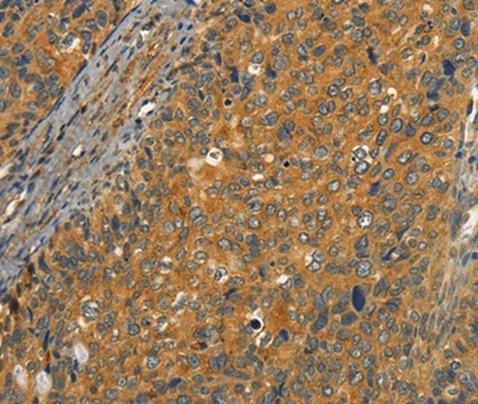 Immunohistochemistry (Formalin/PFA-fixed paraffin-embedded sections) - Anti-CIB1/KIP antibody (AB198845)