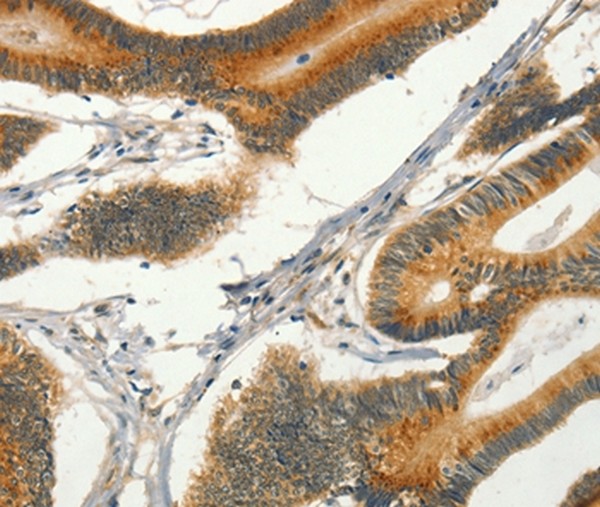 Immunohistochemistry (Formalin/PFA-fixed paraffin-embedded sections) - Anti-CIB1/KIP antibody (AB198845), expandable thumbnail