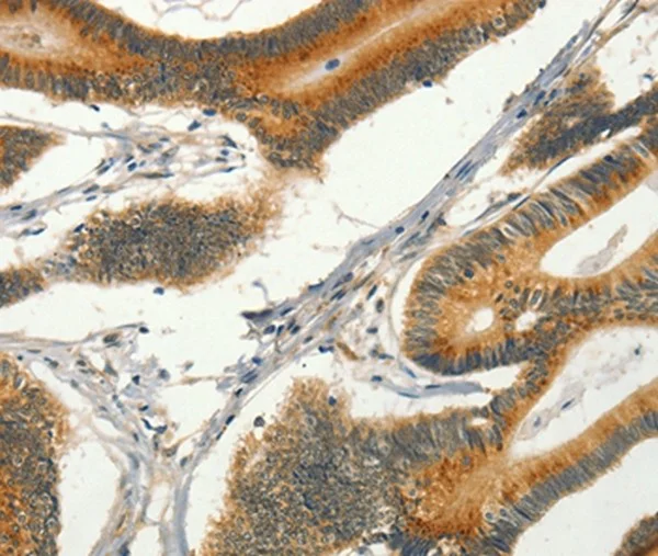 Immunohistochemistry (Formalin/PFA-fixed paraffin-embedded sections) - Anti-CIB1/KIP antibody (AB198845)