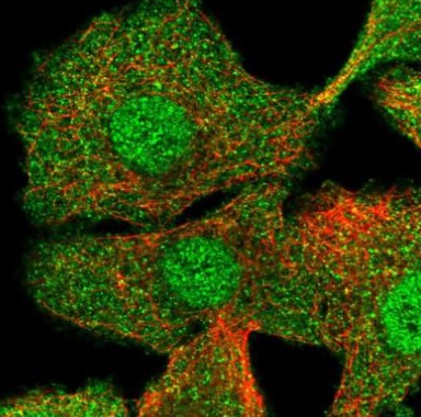 Immunocytochemistry/ Immunofluorescence - Anti-CIB1/KIP antibody (AB220606)
