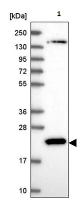 Western blot - Anti-CIB1/KIP antibody (AB220606)
