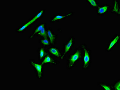 Immunocytochemistry/ Immunofluorescence - Anti-CIB2 antibody (AB234804)