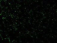 Immunocytochemistry/ Immunofluorescence - Anti-CIDE A antibody (AB62343)